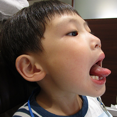 舌伸ばし 舌伸ばし